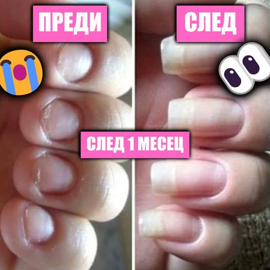 Серум за растеж и здравина на нокти Lazarka
