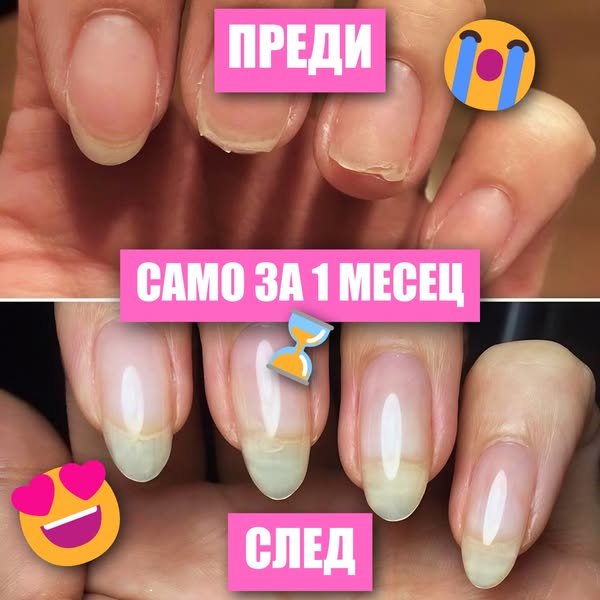 Серум за растеж и здравина на нокти Lazarka