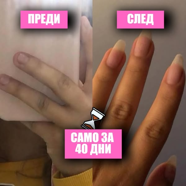 Серум за растеж и здравина на нокти Lazarka